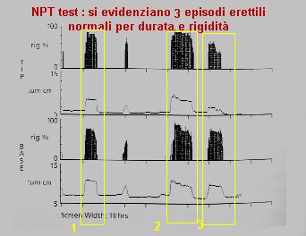 I più comuni esami diagnostici in andrologia